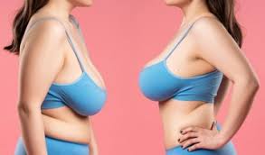 solutions efficaces contre l’affaissement des seins