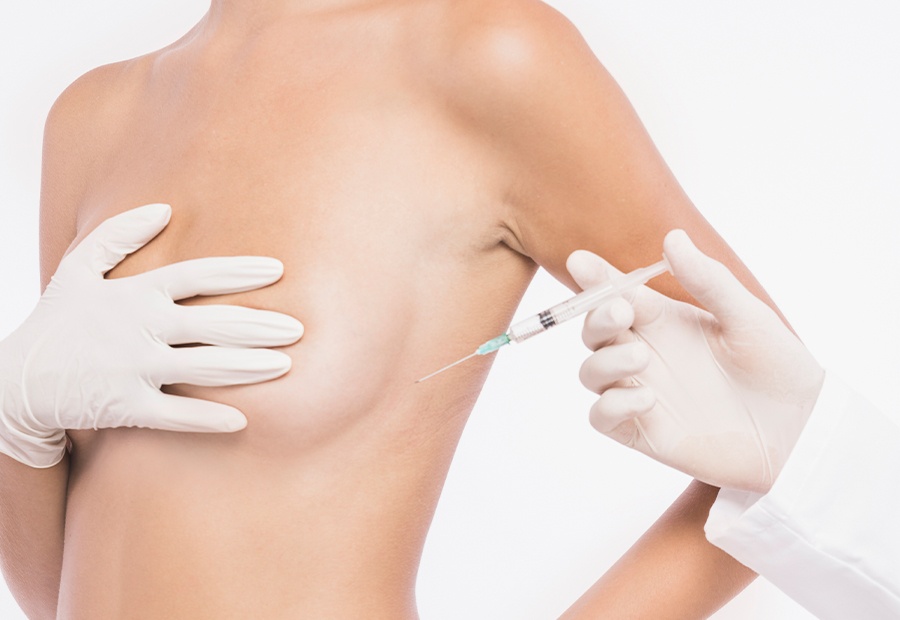 c'est quoi le lipofilling mammaire