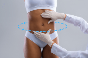 Déroulement liposuccion 360
