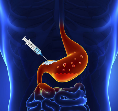 botox gastrique tunisie