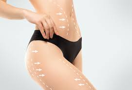 Chirurgie esthétique liposuccion Tunisie prix