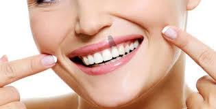 Prix des implants dentaires en Tunisie et tarifs tout compris