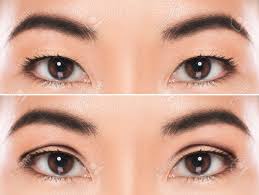 blépharoplastie asiatique tunisie