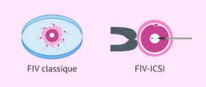 prix fiv tunisie
