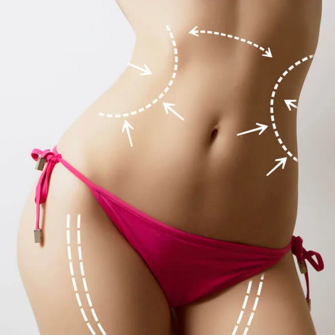 types de liposuccion disponibles en Tunisie