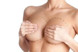 Prix de la chirurgie esthétique pour remodeler les seins en Tunisie