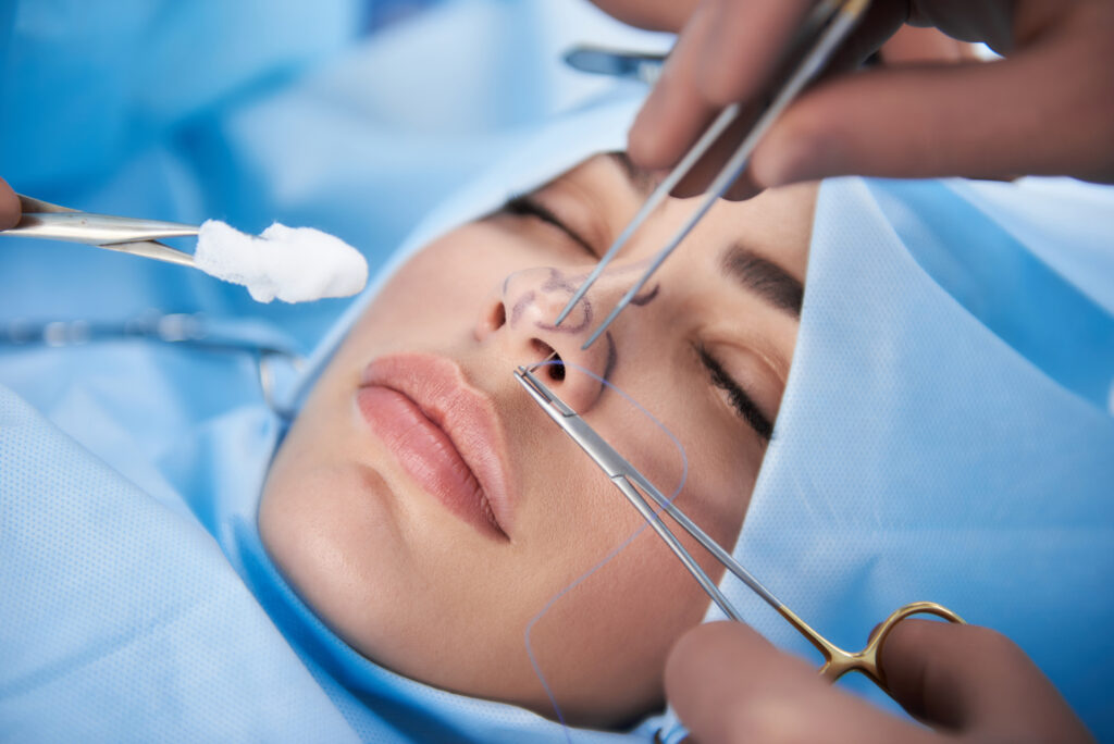 rhinoplastie de révision en Tunisie