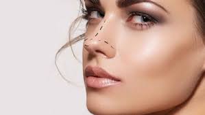 innovations en rhinoplastie