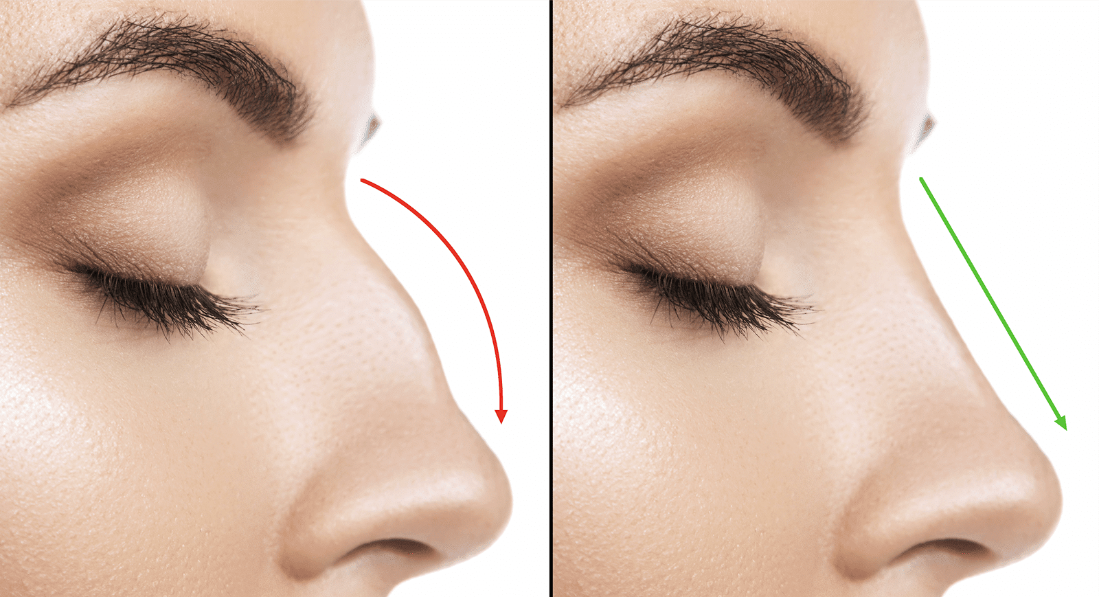package-tout-compris-rhinoplastie-tunisie