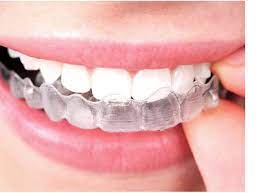 prix Invisalign en Tunisie