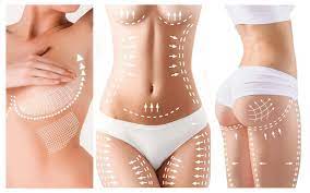 Combiner plusieurs interventions de chirurgie esthétique en Tunisie
