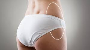 tarif liposuccion hanches tunisie