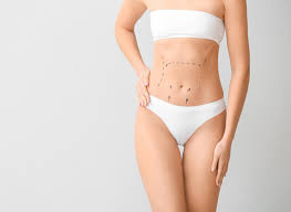 besoin de faire une abdominoplastie