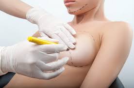 Comment choisir entre le lipofilling mammaire et la pose d'implants mammaires
