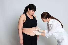 Conseils précédant une chirurgie après une perte de poids rapide