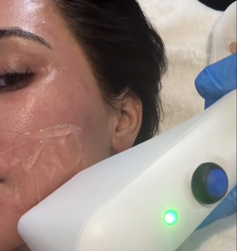 Sofwave Lifting préféré de Kim Kardashian disponible en Tunisie