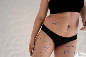 vibrofit liposuccion tunisie