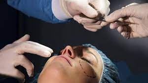 chirurgie medecine esthetique