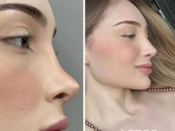 barbie nose
