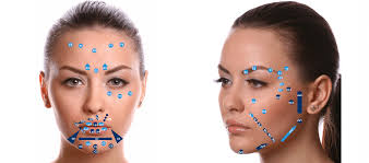 md code acide hyaluronique