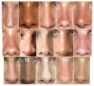 formes de nez